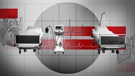 Lay Down Your Ventilator for a Friend Lay Down Your Ventilator for a Friend