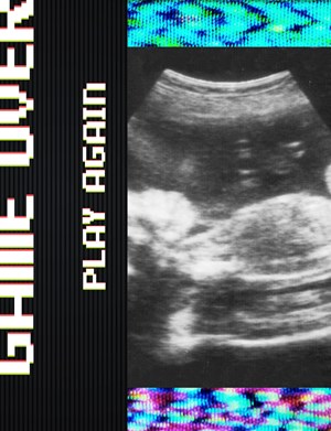 Ultrasound Imaging Ultrasound Imaging