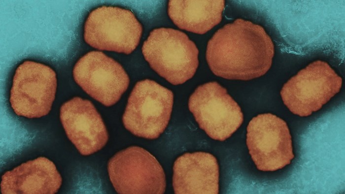 What Church Leaders Should Know about Monkeypox What Church Leaders Should Know about Monkeypox