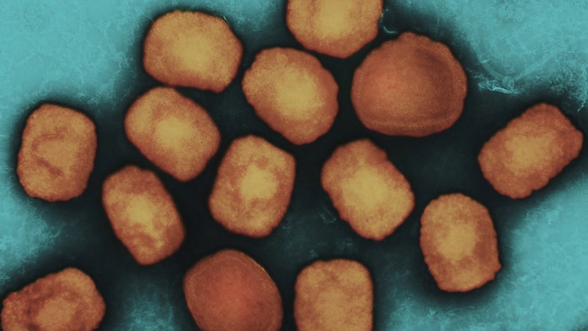 What Church Leaders Should Know about Monkeypox - Vimarsana News