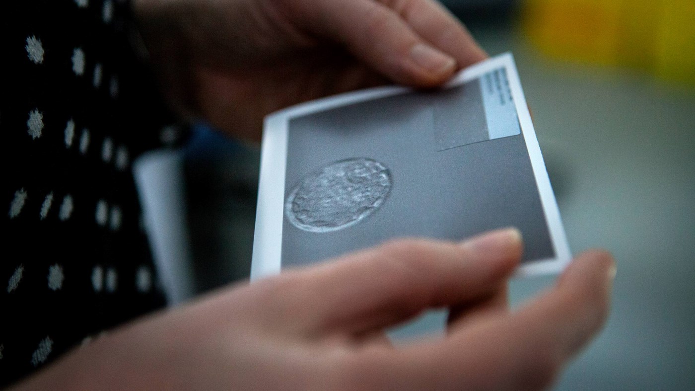 Alabama Rules that Frozen Embryos Are Children...... News & Reporting Christianity Today