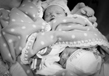 Are Birth Defects Really Part of God's Plan? Are Birth Defects Really Part of God's Plan?