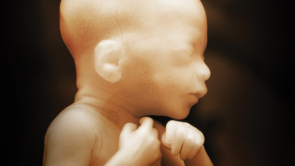 The Problem with the Fetal Pain Abortion Bans