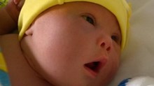 Father of Baby with Down Syndrome Raises $500,000 through Gofundme Father of Baby with Down Syndrome Raises $500,000 through Gofundme