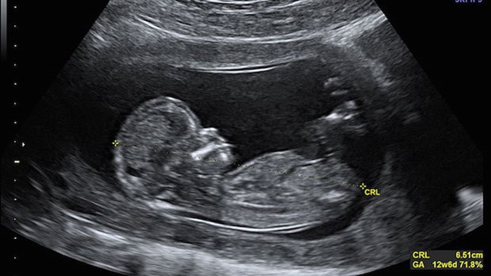 Where are the Mainline and Progressive Evangelical Voices Speaking Up after that Planned Parenthood Tragedy? Where are the Mainline and Progressive Evangelical Voices Speaking Up after that Planned Parenthood Tragedy?