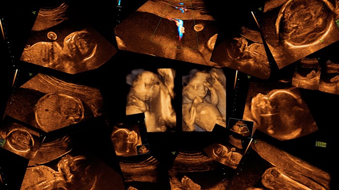 #DefundPP: From Hashtags to Healing #DefundPP: From Hashtags to Healing