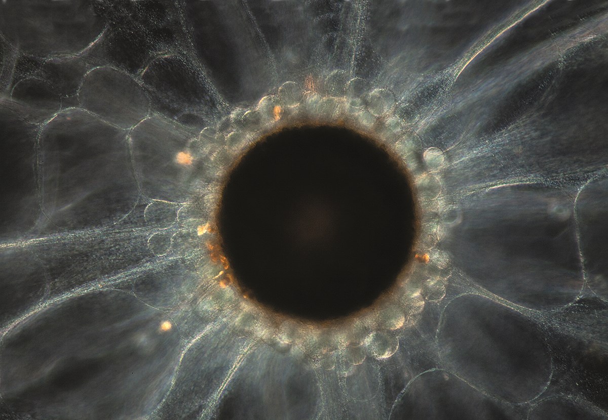 A polycystine radiolarian.