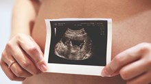 Banning Abortion Based on Down Syndrome? Banning Abortion Based on Down Syndrome?