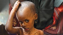 Fighting Famine Isn't Enough