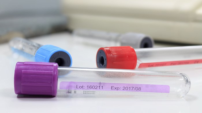 The Painful Questions about Genetics and Race The Painful Questions about Genetics and Race