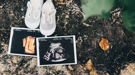 When Our Ultrasound Revealed a Birth Defect, My Doctor Offered an Abortion When Our Ultrasound Revealed a Birth Defect, My Doctor Offered an Abortion